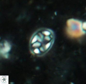Aktasia irregularis 5690