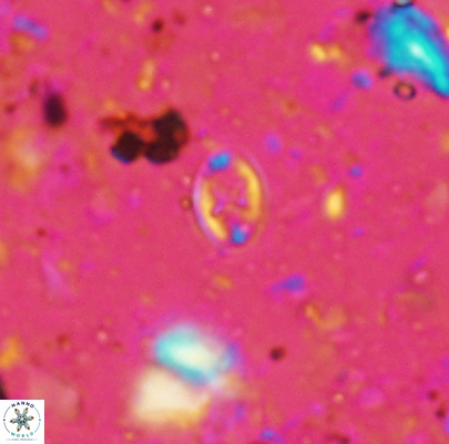 Aktasia leckiei 4491