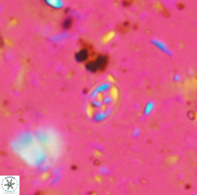 Aktasia leckiei 4494