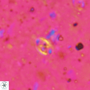 Aktasia leckiei 5781