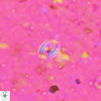 Aktasia leckiei 5785