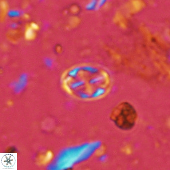 Aktasia parvus VR 15341