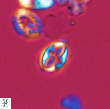 Aktasia turonicus 12400