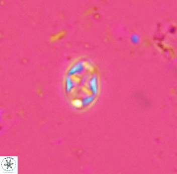 Aktasia trabeculatus 4658