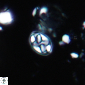 Aktasia trabeculatus 789
