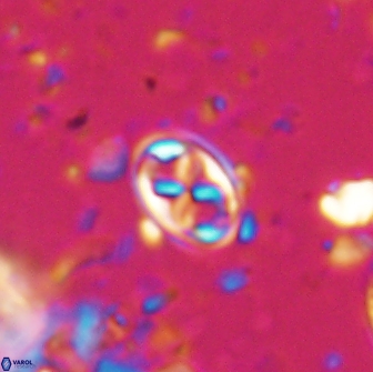 Aktasia trabeculatus 17660