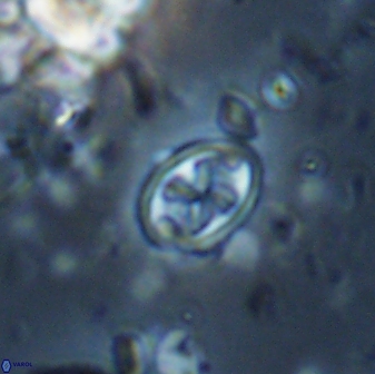 Aktasia trabeculatus 17668