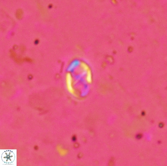 Aktasia trabeculatus 2181