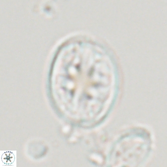 Ahmuellerella octoradiata 17815
