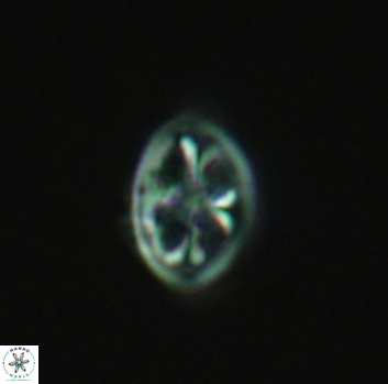 Ahmuellerella octoradiata 3956