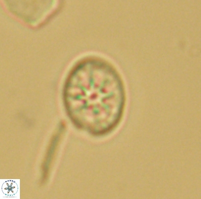 Ahmuellerella hemmoorensis 4384