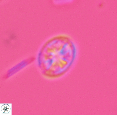 Ahmuellerella hemmoorensis 4390