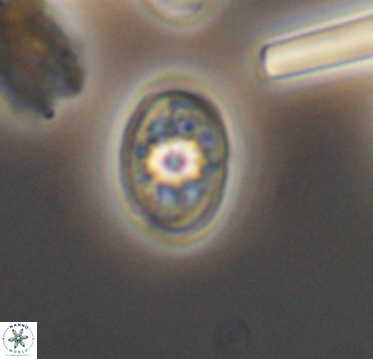 Ahmuellerella hemmoorensis 10398
