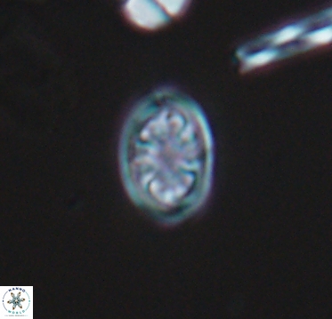 Ahmuellerella hemmoorensis 10400