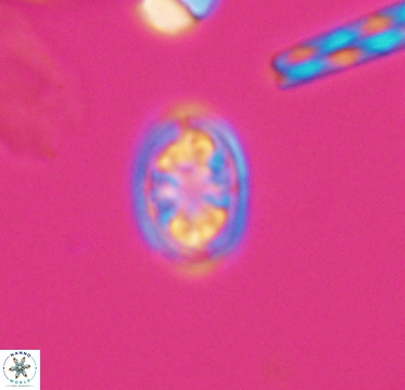 Ahmuellerella hemmoorensis 10401