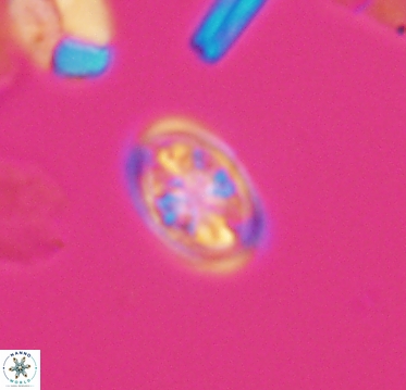 Ahmuellerella hemmoorensis 10403