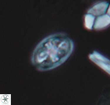 Ahmuellerella hemmoorensis 10404