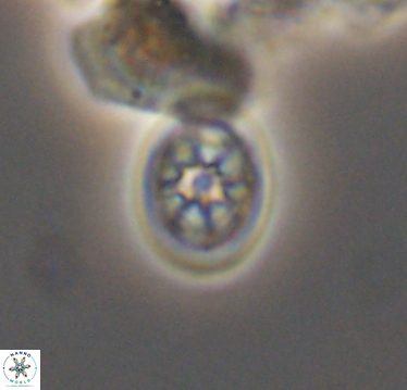 Ahmuellerella hemmoorensis 10415