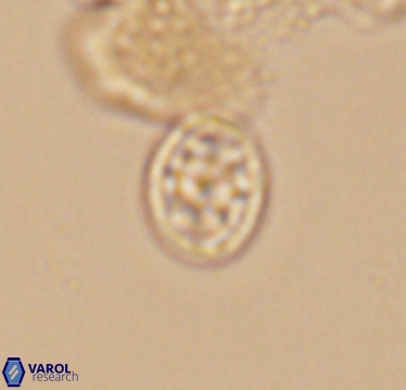 Ahmuellerella hemmoorensis 10416