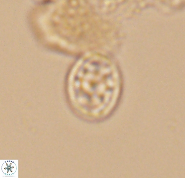 Ahmuellerella hemmoorensis 10416