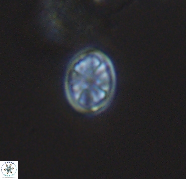 Ahmuellerella hemmoorensis 10417