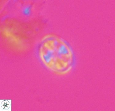 Ahmuellerella hemmoorensis 10420