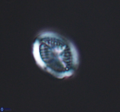 Allemanites glomarus 10871