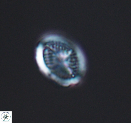 Allemanites glomarus 10871