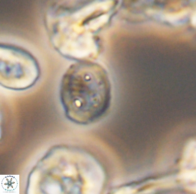 Allemanites scutulatus 12410
