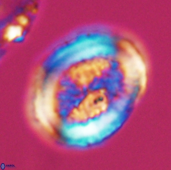 Allemanites striatus 7821