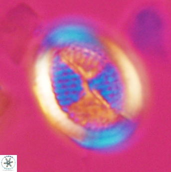 Allemanites striatus 9216
