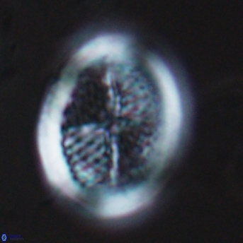 Allemanites striatus 9218