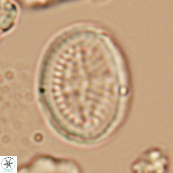 Allemanites striatus 9554