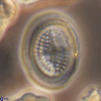 Allemanites striatus 9552