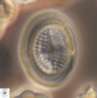 Allemanites striatus 9552