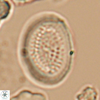 Allemanites striatus 9553