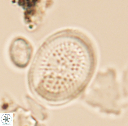 Allemanites striatus 12799