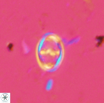 Amphizygus megalops 36115