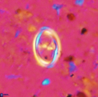 Amphizygus megalops 36507
