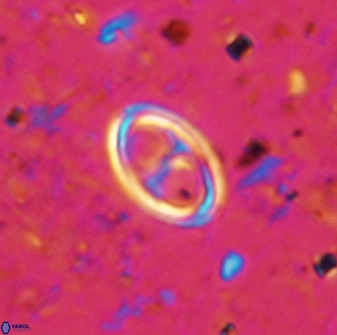 Amphizygus megalops 36509