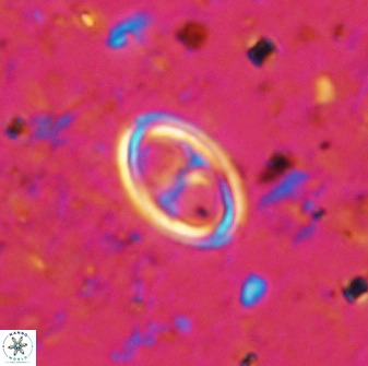Amphizygus megalops 36509