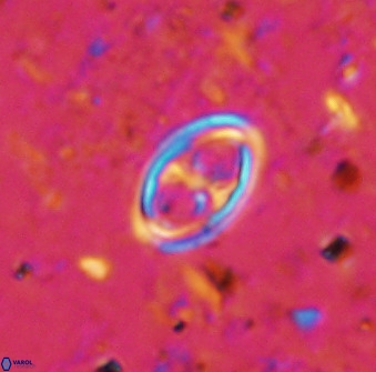 Amphizygus megalops 36511
