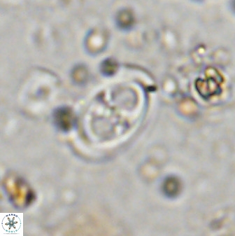 Amphizygus megalops 36715
