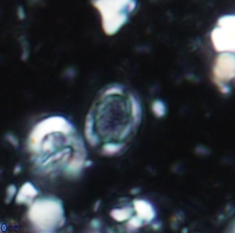 Amphizygus minimus 1543