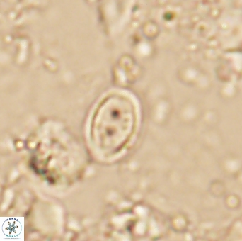 Amphizygus minimus 1542