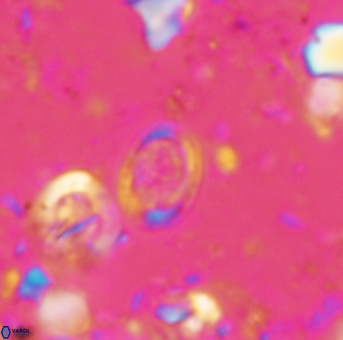 Amphizygus minimus 1544