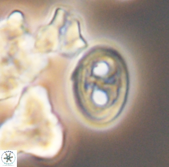 Amphizygus brooksii nanus 6359