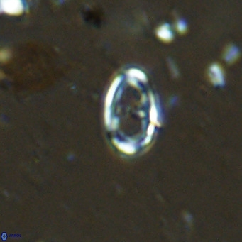 Amphyzygus megalops VR 14884