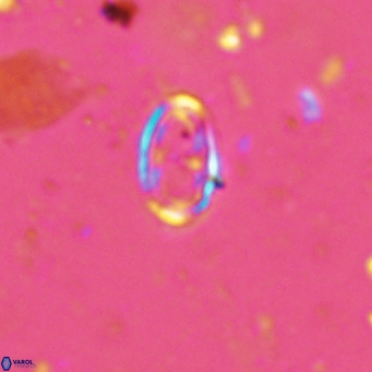 Amphyzygus megalops VR 14885