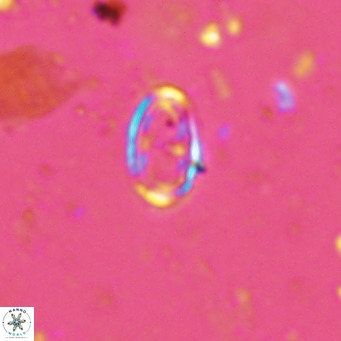 Amphyzygus megalops VR 14885